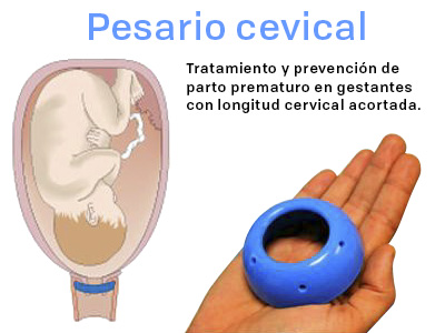 Ginecología Y Diagnóstico Prenatal | Equipo Dr.Chacón: UNIDAD DE ...