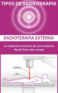 radioterapia externa