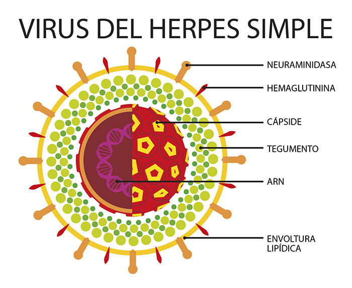 herpes